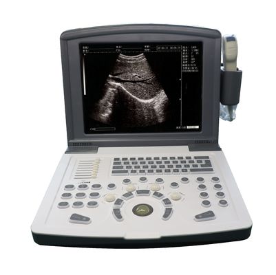 Scanner ad ultrasuoni di diagnostica digitale portatile OEM