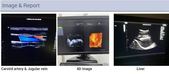 carrello cardiaco Echo Color Doppler Ultrasound Machine della 2D ecocardiografia di 3D 4D