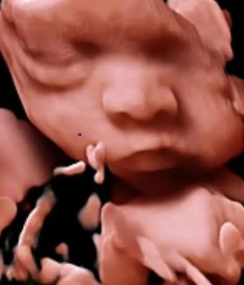 analizzatore di ultrasuono del carrello di ultrasuono di doppler di colore di 3D 4D 5D per OB'GYN