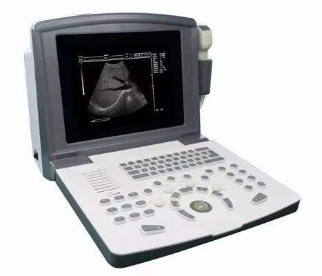 Scanner ad ultrasuoni di diagnostica digitale portatile OEM