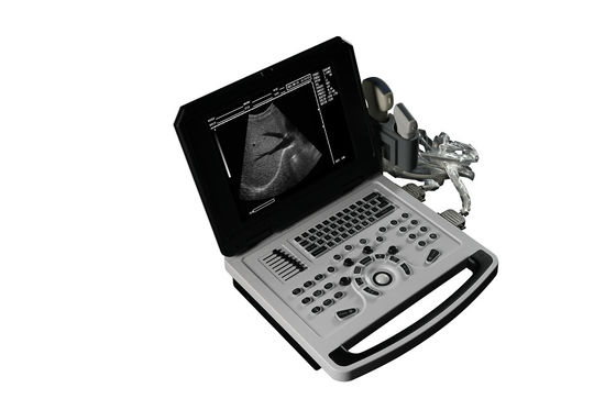 Scanner ad ultrasuoni in bianco e nero per cardiologia