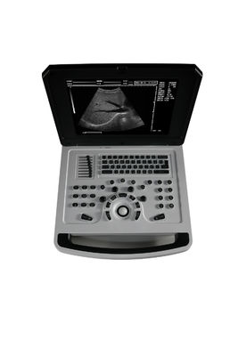 Scanner ad ultrasuoni in bianco e nero per cardiologia
