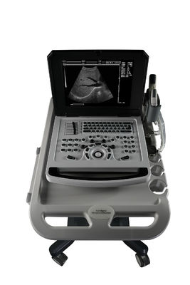 Scanner ad ultrasuoni in bianco e nero per cardiologia